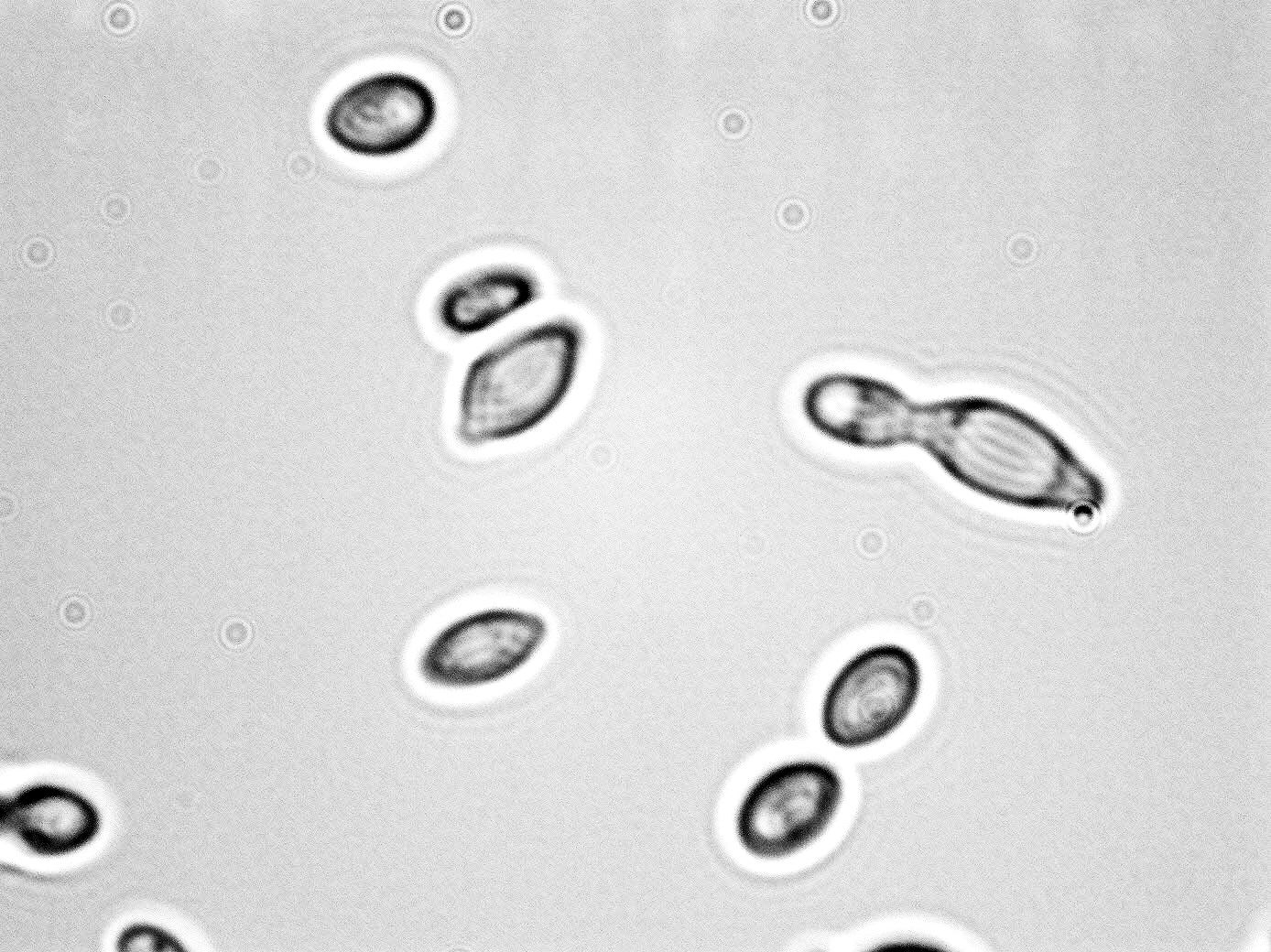 Hanseniaspora uvarum