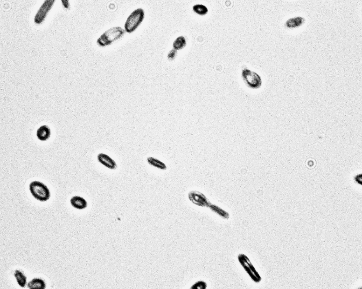 Dekkera bruxellensis