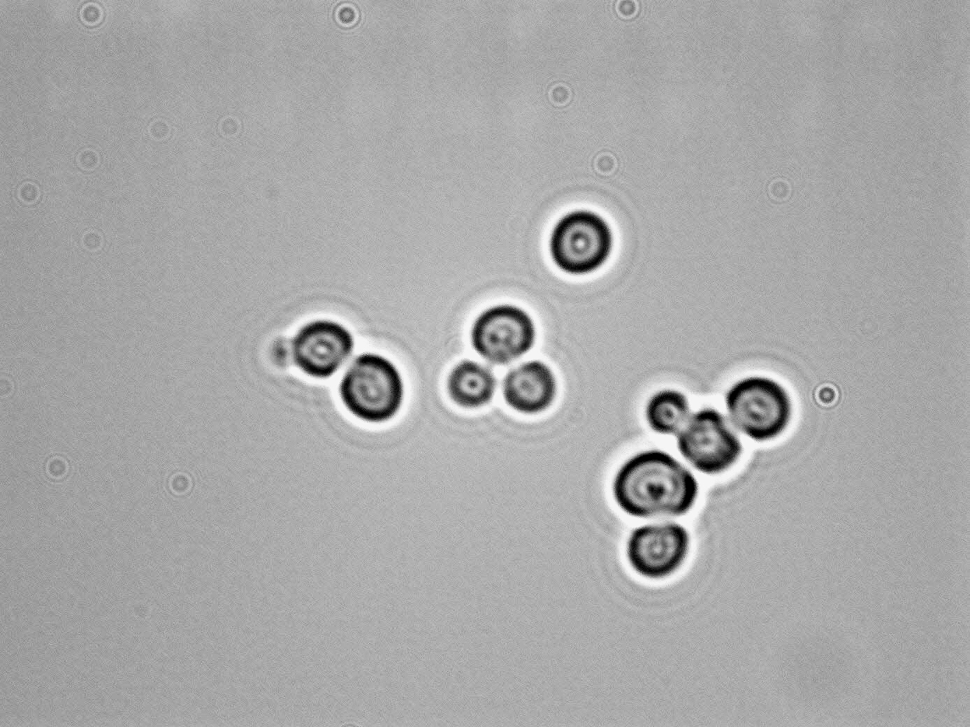 Debaromyces hansenii