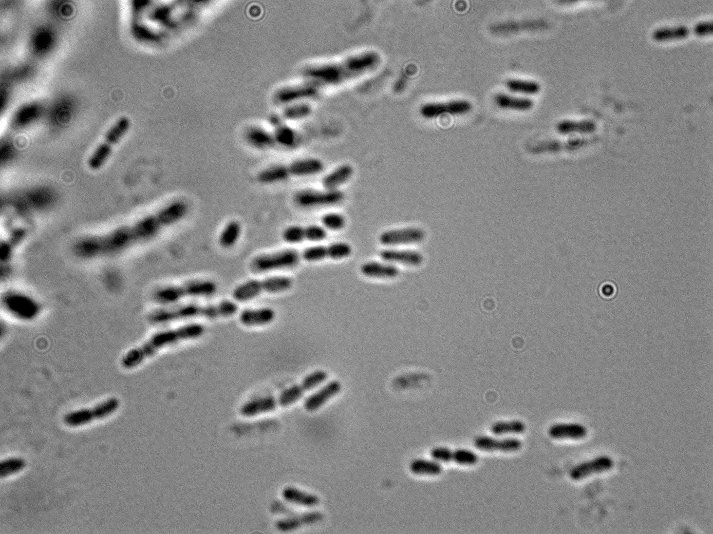 Acetobacter lovaniensis