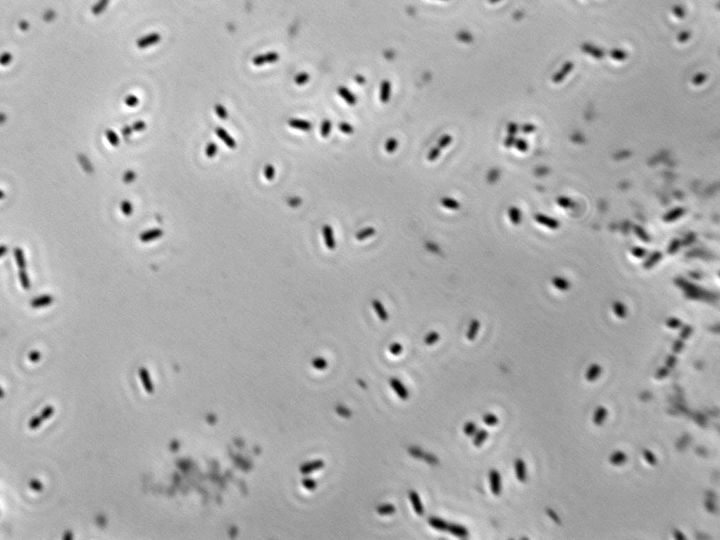 Acetobacter tropicalis