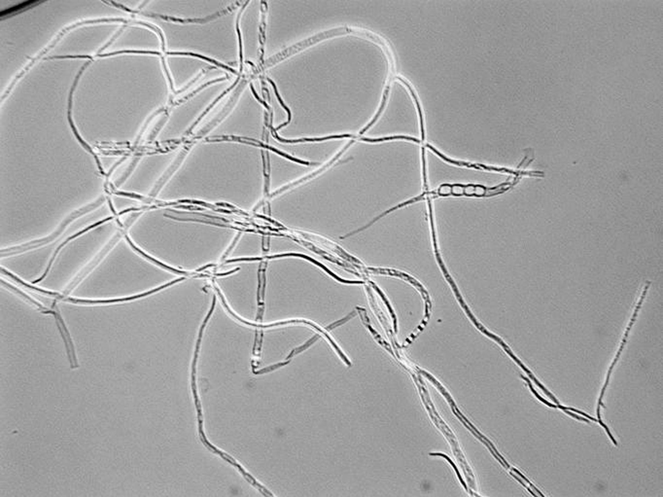 Botrytis cinerea 100x