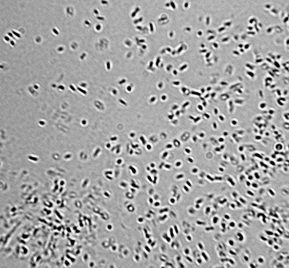 Lactobacillus buchneri