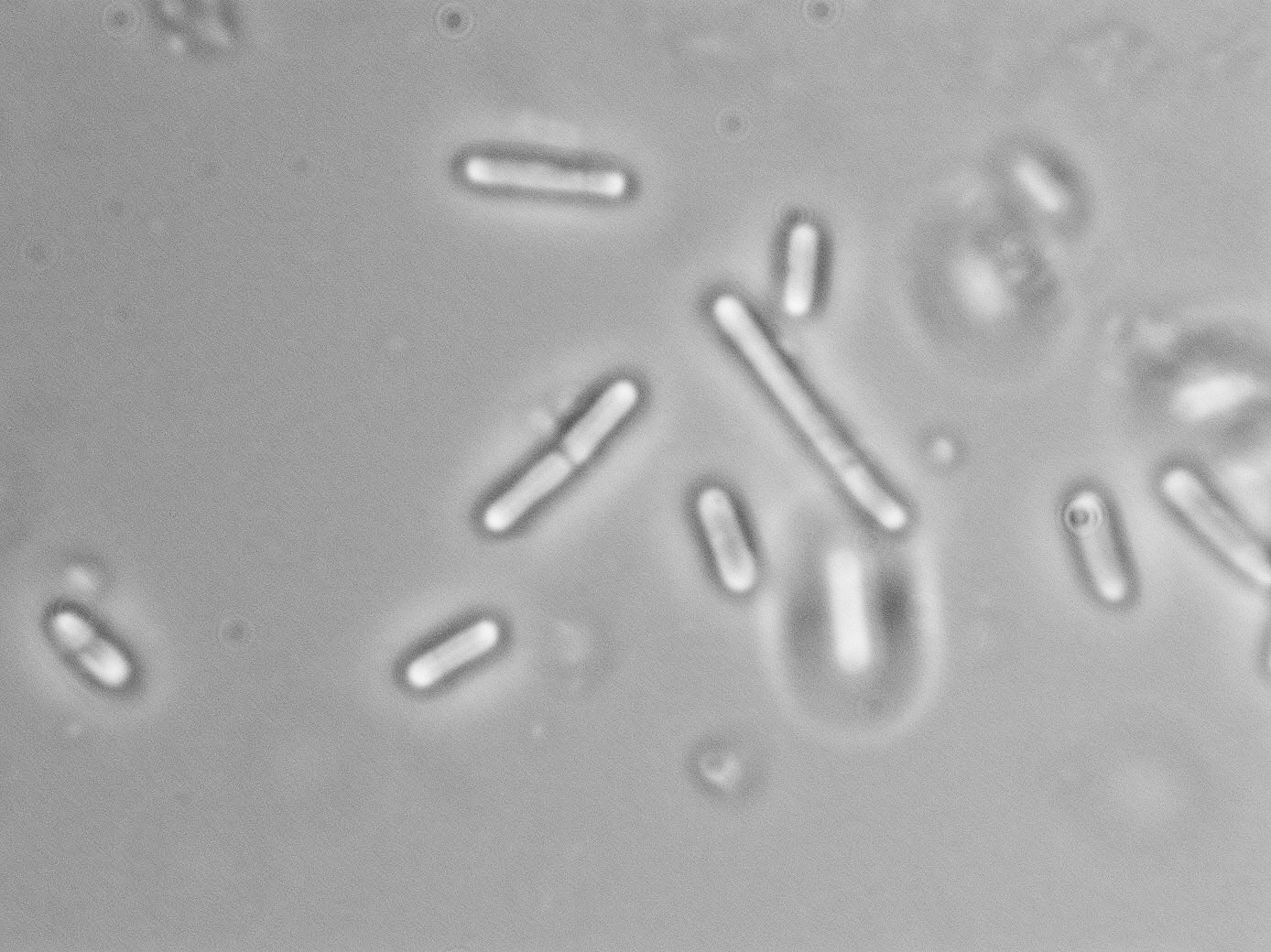 Lactobacillus delbrueckii