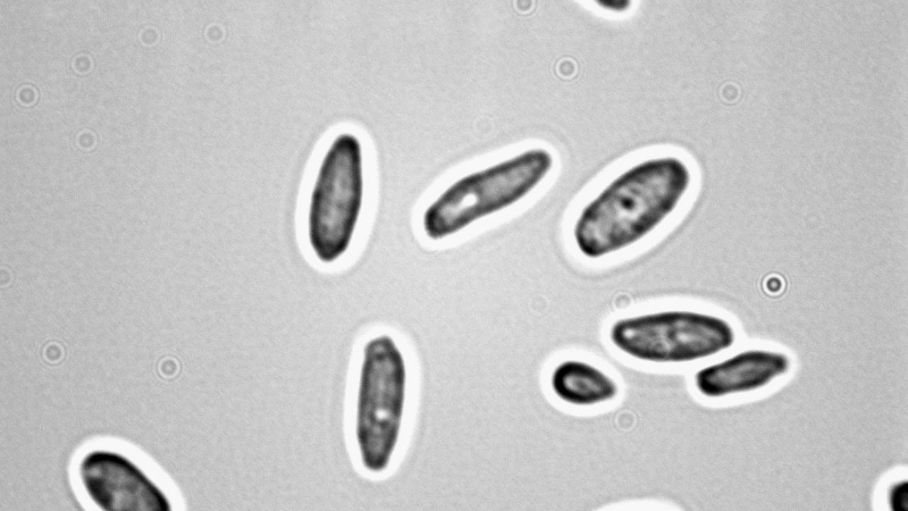 Yeast & Mold