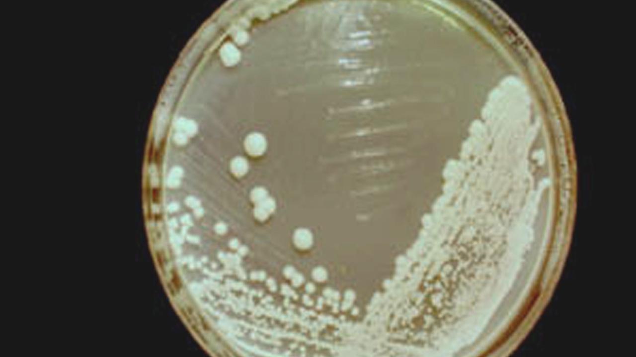 Saccharomyces