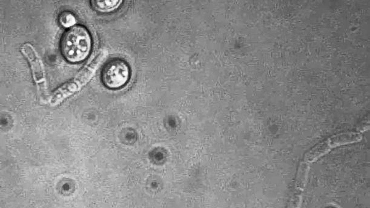 Microscopy